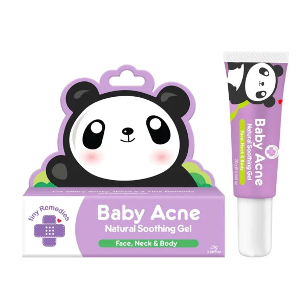 TinyBuds Baby Acne Soothing gel 20g