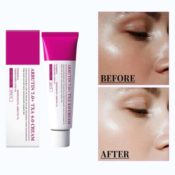 UNAR Arbutin 7% + 4% TXA Acid Cream 50g